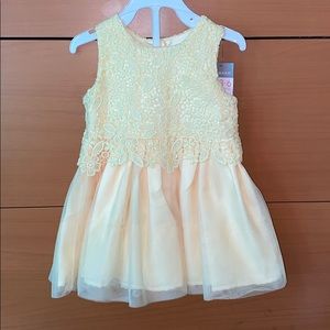 Yellow Laced Tulle Dress